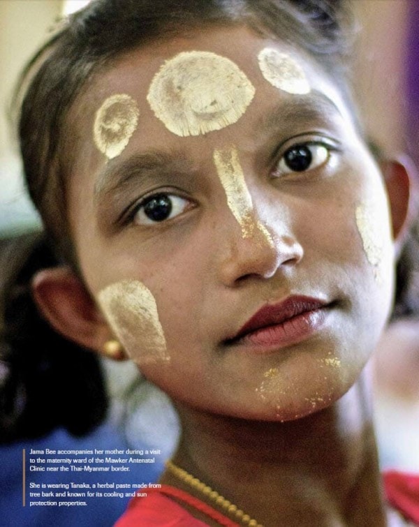 Photo of Jama Bee wearing Tanaka during a visit to the maternity ward of the Mawker Antenatal Clinic near the Thai-Myanmar border featured in Roche Diagram healthcare magazine publications